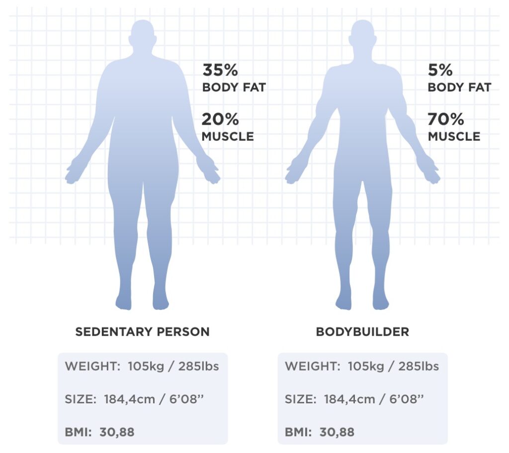 Obesity - Scientific Approach - Top Dietitian in India